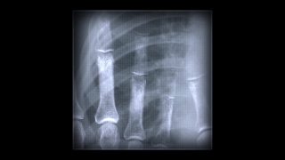 HD Visual Effects, No Copyright Video, Copyright Free, Green Screen, Background, Animation, Download